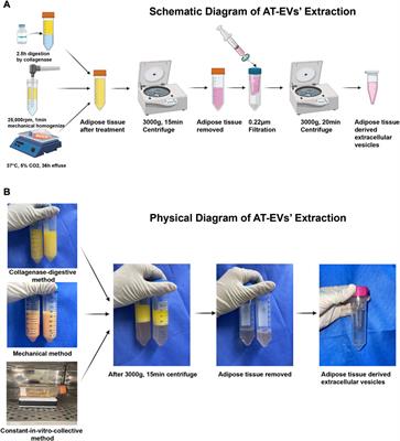 Preparation of therapy-grade extracellular vesicles from adipose tissue to promote diabetic wound healing